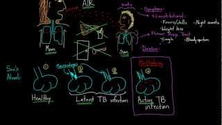 Symptoms and Spread of Tuberculosis [upl. by Huntingdon]