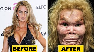 20 Celebrity Plastic Surgery Disasters [upl. by Nybbor]