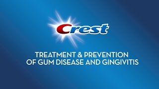 Treatment amp Prevention of Gum Disease and Gingivitis  Crest [upl. by Elimac]