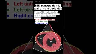 TEE transgastric mid papillary shortaxis view [upl. by Innek]