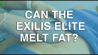 Can the Exilis Elite melt fat  The Body Clinic  Exilis Elite Fat Reduction FAQ 🎯 [upl. by Harwin]