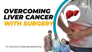 A Patient From Maharashtra Overcomes Liver Cancer  Lowgrade Hepatocellular Carcinoma with Surgery [upl. by Lasiaf]