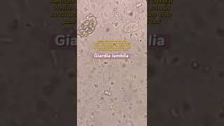 Giardia lamblia under the microscope laboratory microscope mls cls medtechstudent [upl. by Newmark]