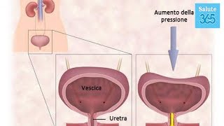 10 trattamenti naturali per la vescica iperattiva  Salute 365 [upl. by Kuehn]