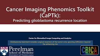 CBICA CaPTk Predicting Glioblastoma Recurrence Location [upl. by Molahs]