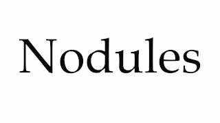 How to Pronounce Nodules [upl. by Ahsilef746]