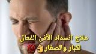 medicament pour les bouchons cerumen👂الدواء لمعالجة انسداد الأذن [upl. by Prent]