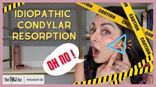 Idiopathic Condylar Resorption  Priya Mistry DDS the TMJ doc idiopathiccondylarresorption icr [upl. by Ffilc]