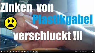 19  Zinken von Plastikgabel verschluckt  Selbsthilfeversuche  Keine Panik   HNO Laryngoskopie [upl. by Aniakudo140]