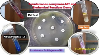 Pseudomonas aeruginosa Antimicrobial sensitivity testing and Biochemical tests Demonstration [upl. by Vic]