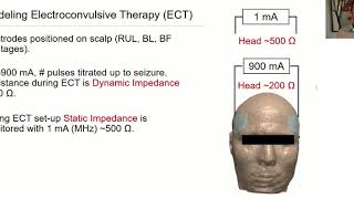 Shared mechanisms of tDCS tACS Temporal Interference Stimulation and ECT [upl. by Darice]