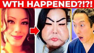 Botched Surgery Gone WILD JUJU DO PIX Extreme Bodies Explained [upl. by Lrad418]