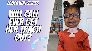 EDUCATION SERIES  WILL CALI EVER GET HER TRACH OUT  LEARN THE STEPS TO DECANNULATION [upl. by Mailliwnhoj617]