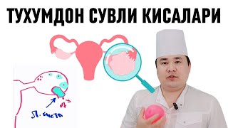 Функционал киста Фолликуляр ва Лютеин кисталари сабалари Асорати ва Даво чоралари хақида Исчанов [upl. by Ongun]