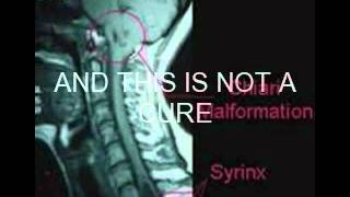 Chiari awareness video [upl. by Denver]