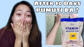 VITAMIN E Whitening Soap x10  Review  Feedback  Result [upl. by Conah192]