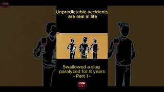 Unpredictable accidents are real in life swallowed a slug paralyzed for 8 years part 1 shorts [upl. by Nannaihr]