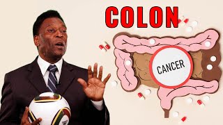 Pele dies after losing battle with COLON CANCER [upl. by Fleeta691]