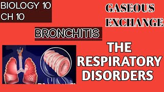 what is bronchitis  respiratory disorders  biology 10 ch 10 SiebertScience [upl. by Shields]