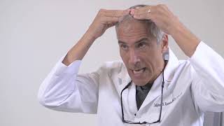 Dr Epstein discusses his approach on Hairline LoweringForehead Reduction [upl. by Aysab]