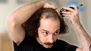 BALDING MAN Shaves Head Totally BALD amp Looks AMAZING [upl. by Coco717]