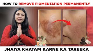 How to remove Pigmentation Permanently  Best Home Remedies  Skin Care Tips  Upasana Ki Duniya [upl. by Kwang]