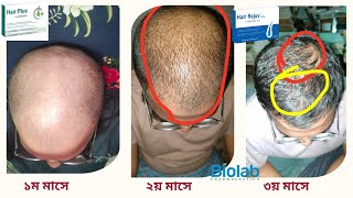 শুধু Hair Plus ৩ মাস খেতে ফলাফল দেখুন [upl. by Bergeron]