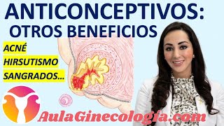 ANTICONCEPTIVOS OTROS BENEFICIOS DOLOR SANGRADO CÁNCER Ginecología y Obtetricia [upl. by Esilehs]