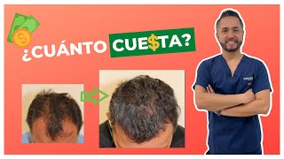 💵🤑¿Cuánto Cuesta un TRASPLANTE DE CABELLO en México [upl. by Netloc314]