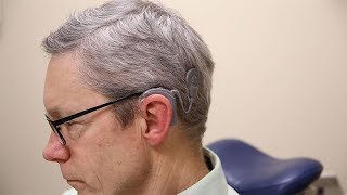 Cochlear™ Implants at Loyola Medicine [upl. by Lynda]