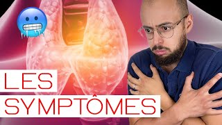 HYPOTHYROIDIE  les symptômes [upl. by Alexandros675]