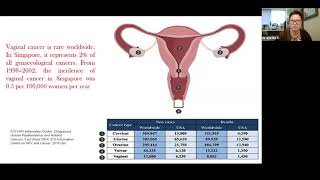 Understanding Female Cancers Vaginal Cancer Webinar 2021  Parkway Cancer Centre [upl. by Kerrie105]