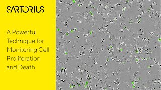 Incucyte® Video preview Introduction to LiveCell Analysis for Cytotoxicity [upl. by Joleen539]