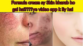 Skin Whitening Cream  Skin Repairing cream  Acne amp pigmentation Cream  Real beauty Secrets [upl. by Ycinuq997]