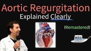 Aortic Regurgitation Aortic Insufficiency Explained Clearly  Remastered [upl. by Erual]