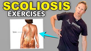 5 Scoliosis Rehab Exercises [upl. by Parcel685]