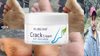 Elibliss Crack Cream  Honest Review [upl. by Eeleak]