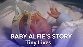 Premature Baby Alfie Arrives Three Months Early  Tiny Lives Series 2  BBC Scotland [upl. by Ahsai]