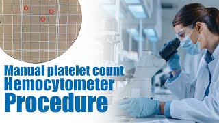 Manual platelet count  hemocytometer Procedure  Calculation  interpretation [upl. by Noli622]