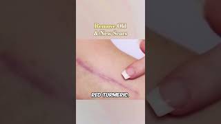 ABERA SCAR CREAM for Face and Body skincare scar treatment stretchmarks beauty bodycare [upl. by Ahsiekim]