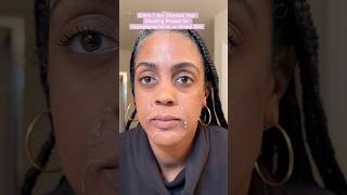 Treating Hyperpigmentation and Dark Spots on Black Skin chemicalpeel blackskincare over40skincare [upl. by Denni]