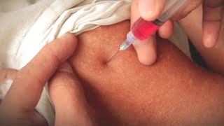 Injection lagane ka tarika  how to give intramuscular injection  nursing school Ep05 [upl. by Bartel]