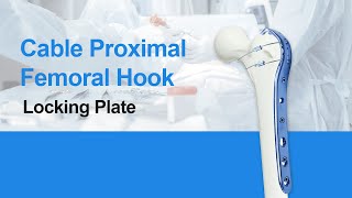 CZMEDITECHProximal Femoral Hook Locking Plate with Cable Locking plate Orthopedics implants [upl. by Anyzratak]