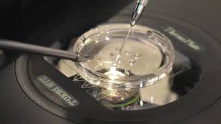 The Process of Intracytoplasmic Sperm Injection for IVF [upl. by Suzanne138]