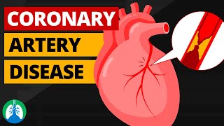 Coronary Artery Disease Medical Definition  Quick Explainer Video [upl. by Vig]