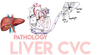 Liver CVC Congestive hepatopathy  IN EASY MANNER  Right Sided Heart Failure  Liver Necrosis [upl. by Narej940]