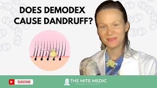 DEMODEX MITES CAUSE DANDRUFF [upl. by Terti824]