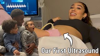 OUR FIRST ULTRASOUND Emotional [upl. by Adiv]