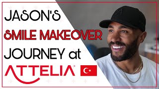 JASONS SMILE MAKEOVER JOURNEY attelia milliondollarsmile [upl. by Aihsotan]