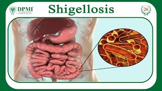 Shigellosis What Causes Shigellosis Shigella Morphology Classification Transmission amp Treatment [upl. by Yrruc82]